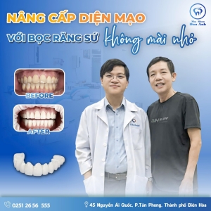 nang-cap-dien-mao-banh-bao-bang-nu-cuoi-day-nam-tinh