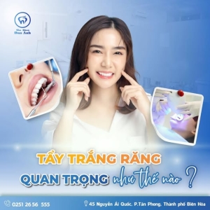 tay-trang-rang-giup-cho-nu-cuoi-tu-tin-la-mot-trong-nhung-yeu-cau-quan-trong-trong-giao-tiep