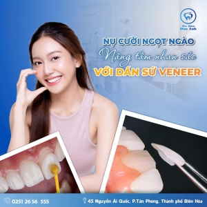 nu-cuoi-ngot-ngao-nang-tam-nhan-sac