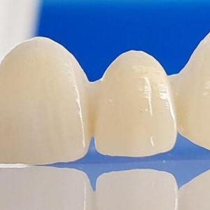 rang-su-zirconia