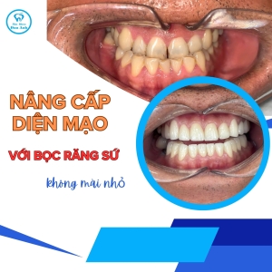 nang-cap-dien-mao-banh-bao-bang-nu-cuoi-day-nam-tinh-2