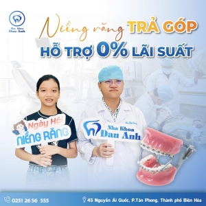 nieng-rang-cuc-de-tra-gop-cuc-ngau