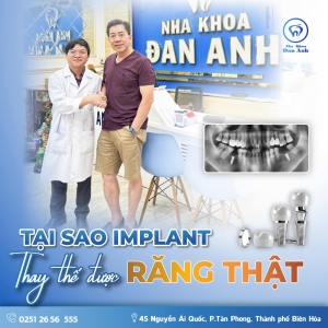 rang-implant-gan-giong-100-rang-that