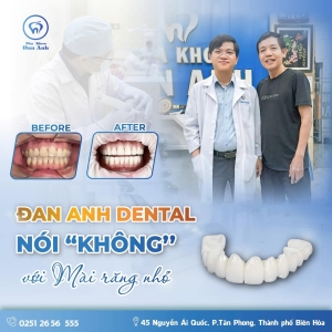 sieu-cong-nghe-tham-my-rang-khong-mai-nho-chuan-bo-y-te